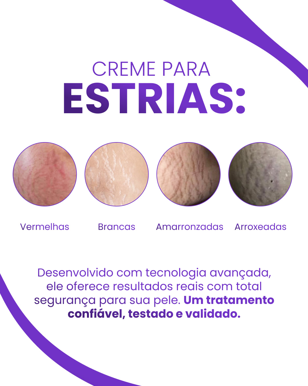 Leve 4 Pague 3 - Creme Para Estrias