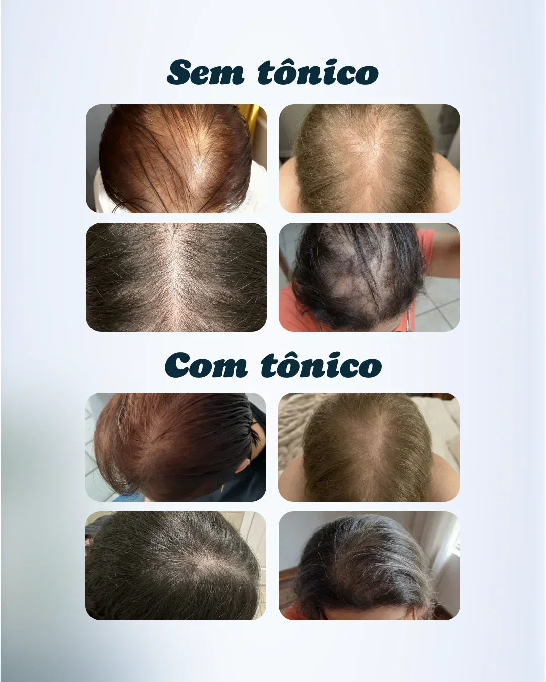 Adonay Tônico Capilar