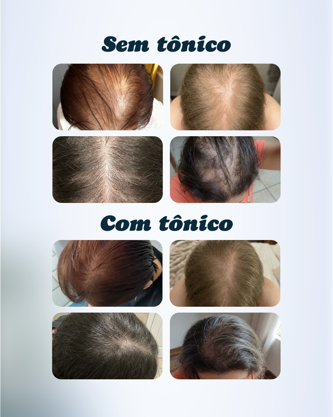 Adonay Tônico Capilar