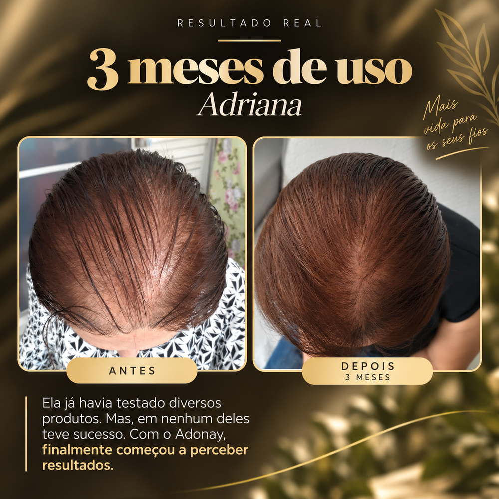 Combo de 2 Adonay Tônico Capilar